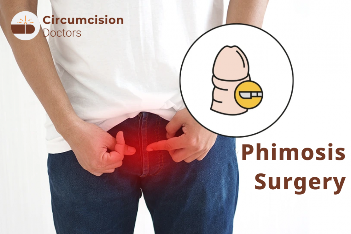 Phimosis Treatment - Surgery Procedure, Risks, and Benefits